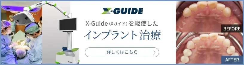 X-Guide(Xガイド)を駆使したインプラント治療